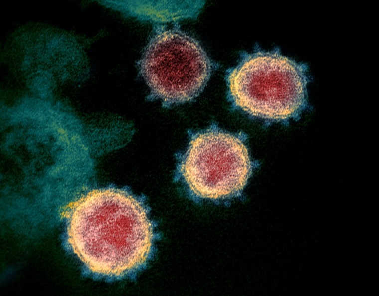 FILE - This undated electron microscope image made available by the U.S. National Institutes of Health in February 2020 shows the virus that causes COVID-19. The sample was isolated from a patient in the U.S. On Friday, Dec. 11, 2020, The Associated Press reported on stories circulating online incorrectly asserting that scientists have not isolated the COVID-19 virus, so a vaccine is not possible. The virus was first isolated by Chinese authorities on Jan. 7, according to the World Health Organization. (NIAID-RML via AP)